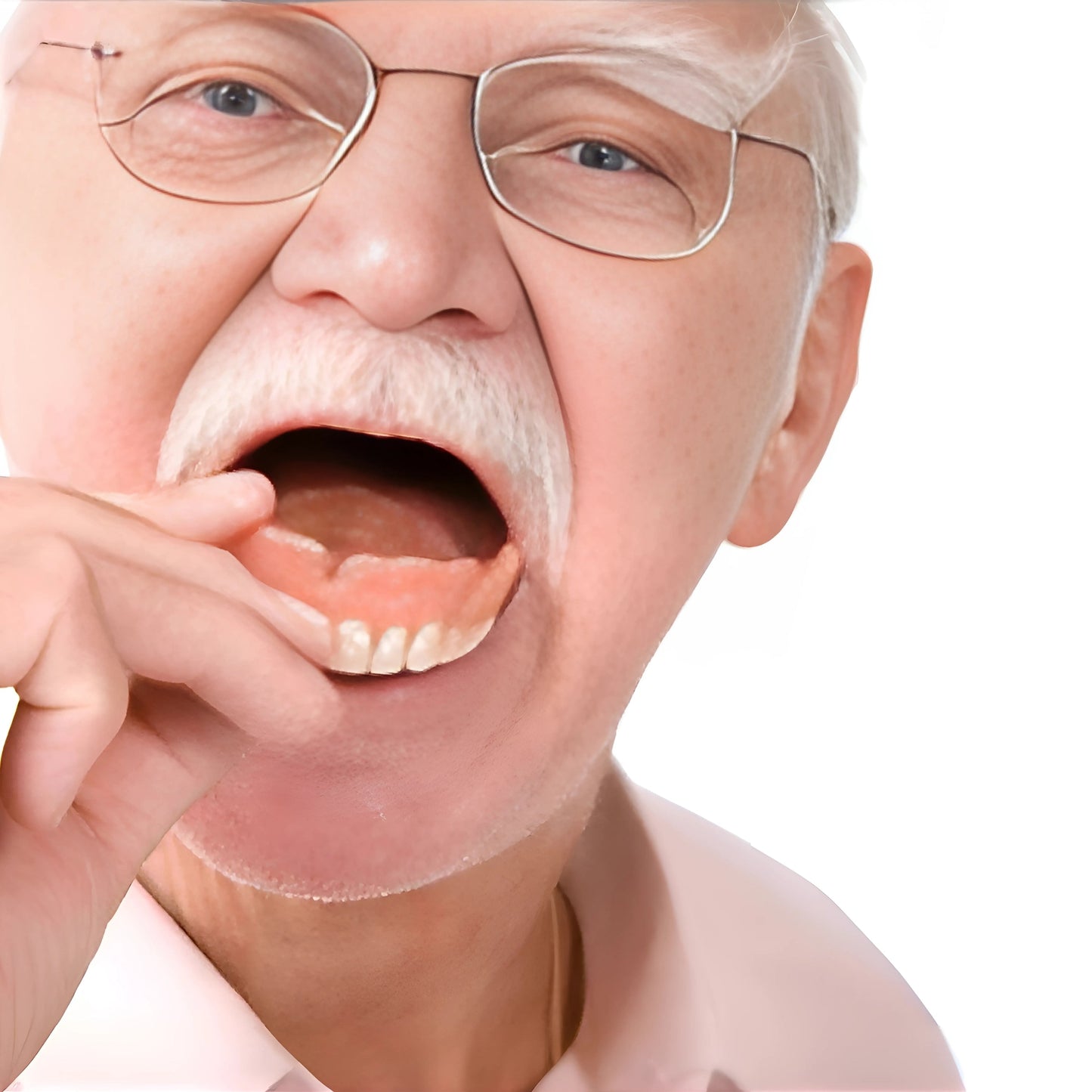 VeneerEase™ - Denture Set